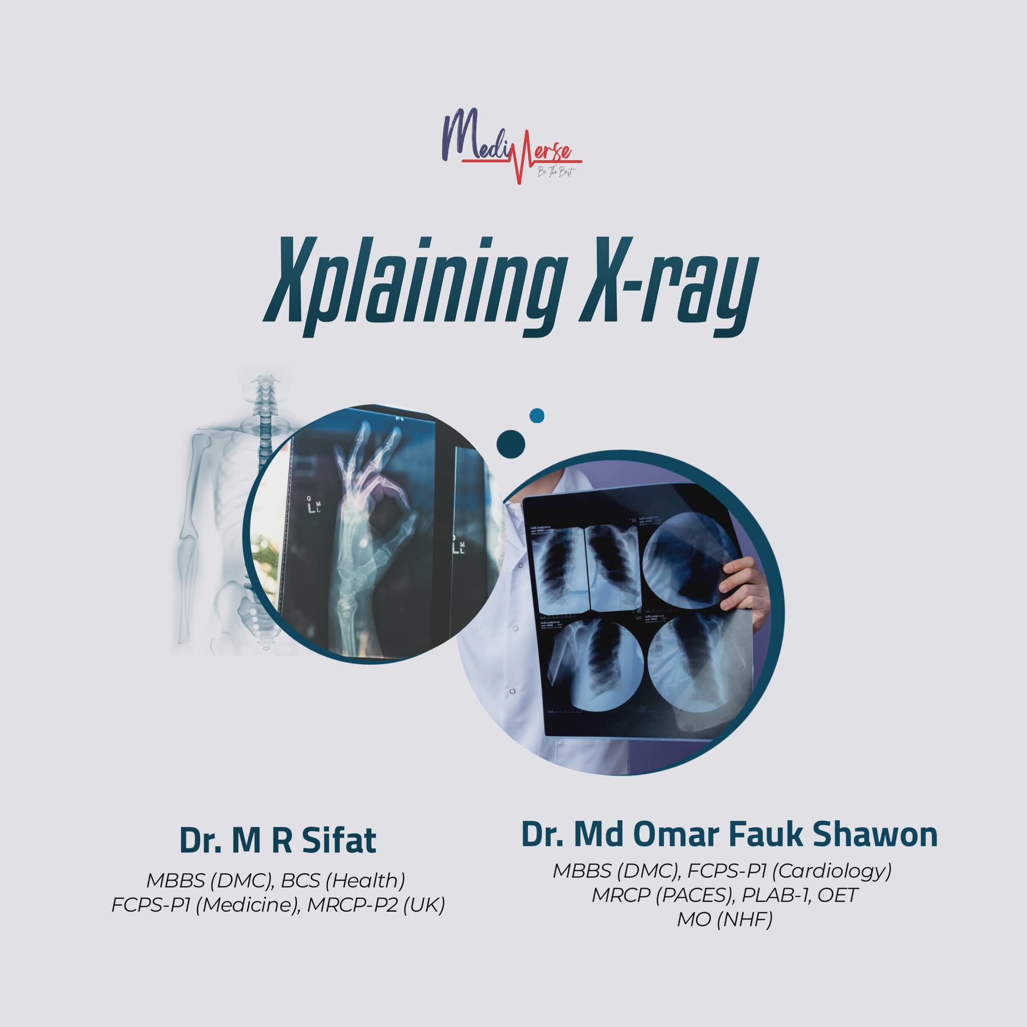 Xplaining X-ray
